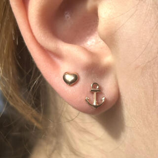 Knubbel im Ohrläppchen – Ursachen, Symptome & Behandlung